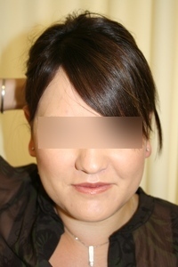 After