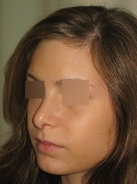 After