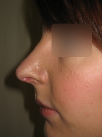 After