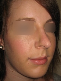 After
