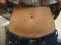 Before
