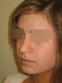 Before