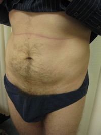 Before