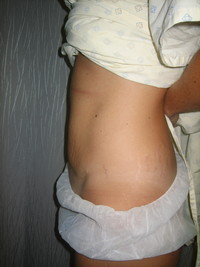 Before