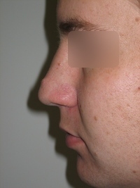 Before
