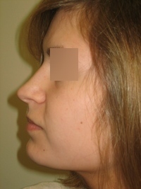 Before