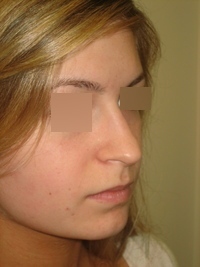 Before
