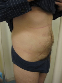 Before