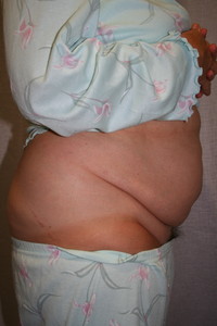 Before