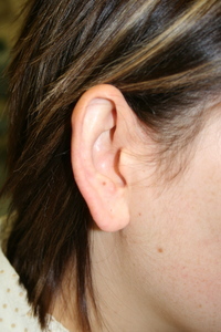 Before