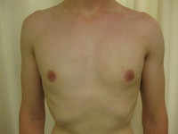 After (Final Result)