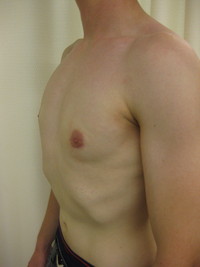 After (Final Result)