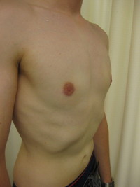 After (Final Result)