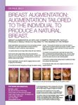 Breast augmentation: augmentation tailored to the individual to produce a natural breast image #2