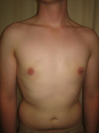 After