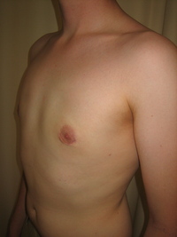 After