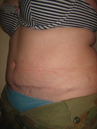 After