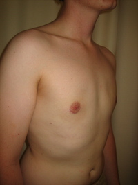 After