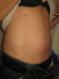 After