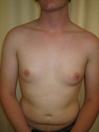 Before