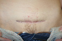 Before